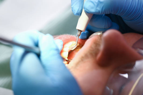 Best Mobile Emergency Dentist in Wyldwood, TX